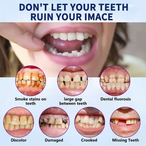 Bikenda™-🦷Advanced Customized Full Denture Set🦷