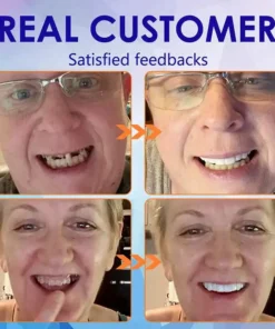 Bikenda™-🦷Advanced Customized Full Denture Set🦷