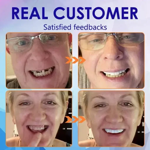 Bikenda™-🦷Advanced Customized Full Denture Set🦷
