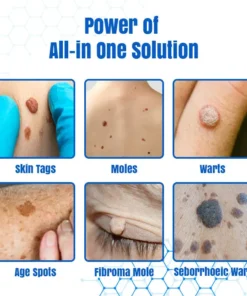 Bikenda® DermZap Mole & Wart Removal Laser Pen