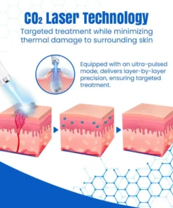 𝑩𝐢𝐤𝐞𝐧𝐝𝐚® 𝐃𝐞𝐫𝐦𝒁𝐚𝐩 𝑵𝐁-𝐔𝐕𝐁 𝑴𝐨𝐥𝐞 & 𝑾𝐚𝐫𝐭 𝑹𝐞𝐦𝐨𝐯𝐚𝐥 𝑷𝐡𝐨𝐭𝐨𝐭𝐡𝐞𝐫𝐚𝐩𝐲 𝑳𝐚𝐬𝐞𝐫 𝑷𝐞𝐧