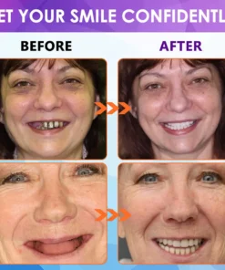 𝐁𝐢𝐤𝐞𝐧𝐝𝐚® 𝐒𝐢𝐥𝐢𝐜𝐨𝐧𝐞 𝐑𝐞𝐥𝐢𝐧𝐞 𝐃𝐞𝐧𝐭𝐮𝐫𝐞 𝐒𝐞𝐭