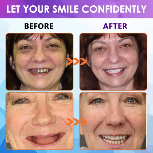 𝐁𝐢𝐤𝐞𝐧𝐝𝐚® 𝐒𝐢𝐥𝐢𝐜𝐨𝐧𝐞 𝐑𝐞𝐥𝐢𝐧𝐞 𝐃𝐞𝐧𝐭𝐮𝐫𝐞 𝐒𝐞𝐭