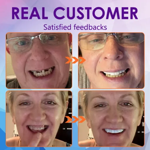 𝐁𝐢𝐤𝐞𝐧𝐝𝐚® 𝐒𝐢𝐥𝐢𝐜𝐨𝐧𝐞 𝐑𝐞𝐥𝐢𝐧𝐞 𝐃𝐞𝐧𝐭𝐮𝐫𝐞 𝐒𝐞𝐭