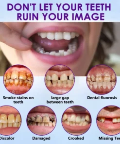 𝐁𝐢𝐤𝐞𝐧𝐝𝐚® 𝐒𝐢𝐥𝐢𝐜𝐨𝐧𝐞 𝐑𝐞𝐥𝐢𝐧𝐞 𝐃𝐞𝐧𝐭𝐮𝐫𝐞 𝐒𝐞𝐭