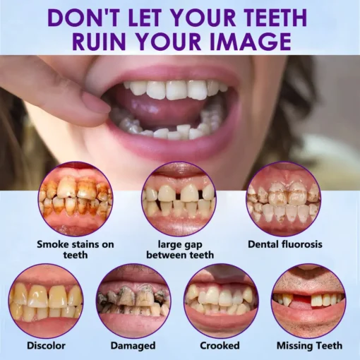 𝐁𝐢𝐤𝐞𝐧𝐝𝐚® 𝐒𝐢𝐥𝐢𝐜𝐨𝐧𝐞 𝐑𝐞𝐥𝐢𝐧𝐞 𝐃𝐞𝐧𝐭𝐮𝐫𝐞 𝐒𝐞𝐭