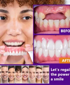 𝐁𝐢𝐤𝐞𝐧𝐝𝐚® 𝐒𝐢𝐥𝐢𝐜𝐨𝐧𝐞 𝐑𝐞𝐥𝐢𝐧𝐞 𝐃𝐞𝐧𝐭𝐮𝐫𝐞 𝐒𝐞𝐭