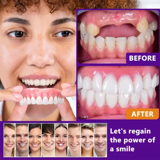 𝐁𝐢𝐤𝐞𝐧𝐝𝐚® 𝐒𝐢𝐥𝐢𝐜𝐨𝐧𝐞 𝐑𝐞𝐥𝐢𝐧𝐞 𝐃𝐞𝐧𝐭𝐮𝐫𝐞 𝐒𝐞𝐭