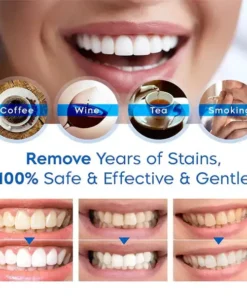 𝐁𝐢𝐤𝐞𝐧𝐝𝐚™ 𝗧𝗲𝗲𝘁𝗵 𝗪𝗵𝗶𝘁𝗲𝗻𝗶𝗻𝗴 𝐄𝐬𝐬𝐞𝐧𝐜𝐞 𝗣𝗲𝗻