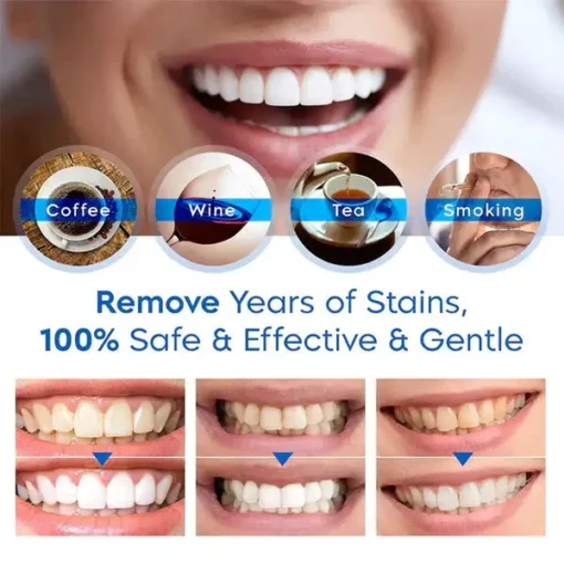 𝐁𝐢𝐤𝐞𝐧𝐝𝐚™ 𝗧𝗲𝗲𝘁𝗵 𝗪𝗵𝗶𝘁𝗲𝗻𝗶𝗻𝗴 𝐄𝐬𝐬𝐞𝐧𝐜𝐞 𝗣𝗲𝗻