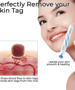Bikenda® At-home Skin Tag Removal Pen