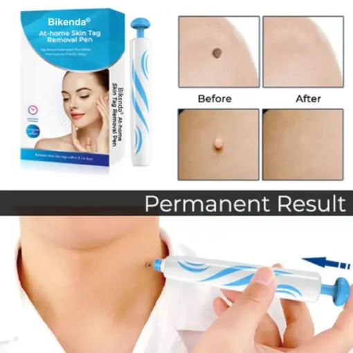 Bikenda® At-home Skin Tag Removal Pen