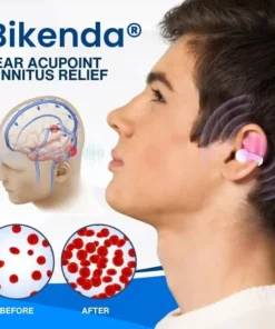 Bikenda® Ear Acupoint Tinnitus Relief