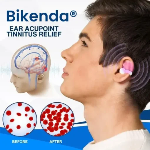 Bikenda® Ear Acupoint Tinnitus Relief
