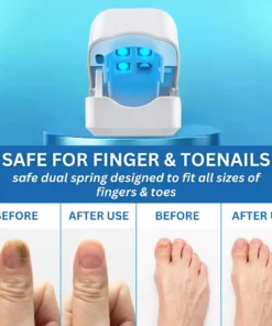 Bikenda® Nail Fungus Laser Treatment Device