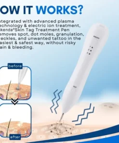 Bikenda® Skin Tag Treatment Pen