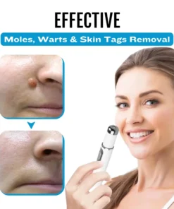 Bikenda® SpotlessDerm Mole and Wart Laser Pen