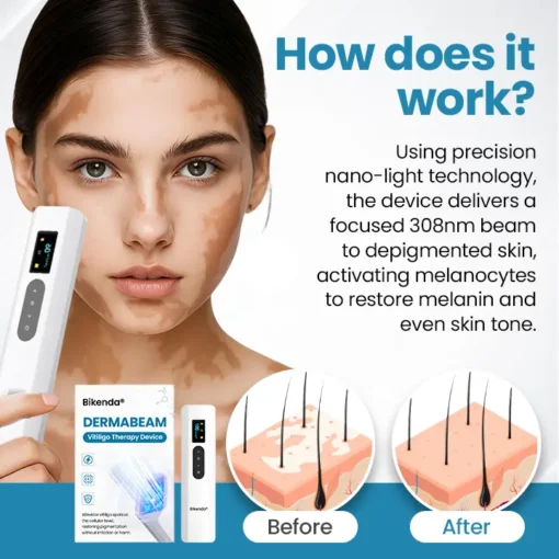 Bikenda® DermaBeam Vitiligo Therapy device