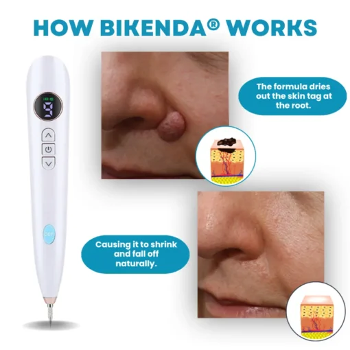 Bikenda® Home Use CO2 Laser Shot Erase Pro