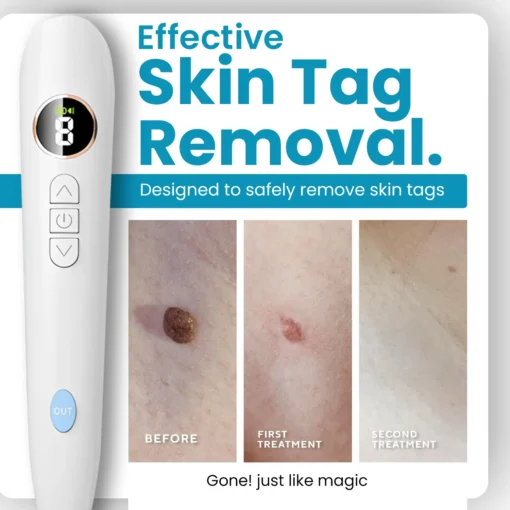 Bikenda® Home Use CO2 Laser Shot Erase Pro