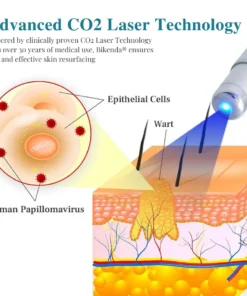 Bikenda® LumeSkin Mole and Wart Removal Laser Pen