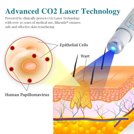 Bikenda® LumeSkin Mole and Wart Removal Laser Pen