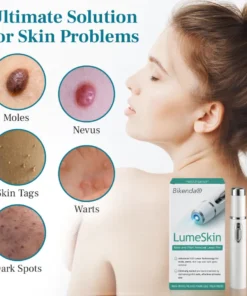 Bikenda® LumeSkin Mole and Wart Removal Laser Pen