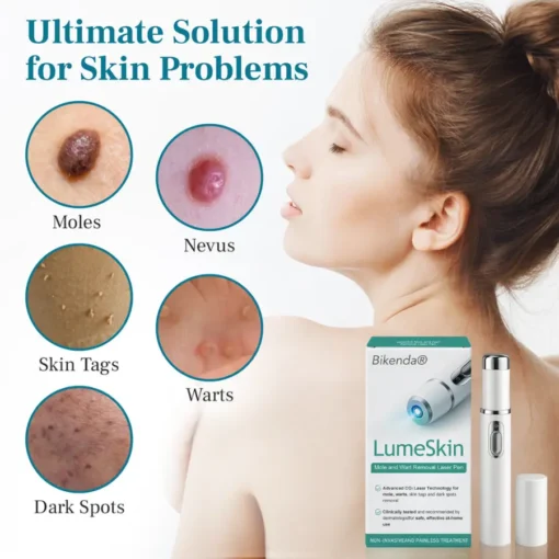 Bikenda® LumeSkin Mole and Wart Removal Laser Pen