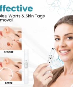 Bikenda® Professional Non-Invasive Mole and Wart Removal Laser Pen