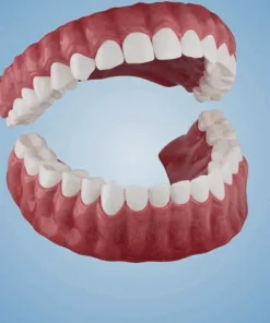 Bikenda®Advanced Full Denture Set