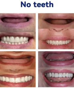 Bikenda®Advanced Full Denture Set