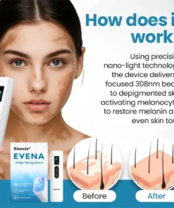 Bikenda® Evena Vitiligo Therapy Device