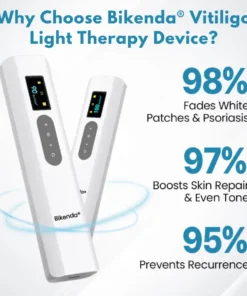 Bikenda® Vitiligo Light Therapy Device