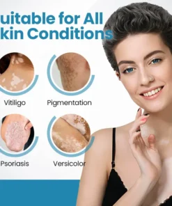 Bikenda® Vitiligo Light Therapy Device