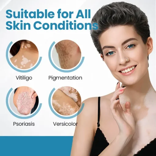 Bikenda® Vitiligo Light Therapy Device