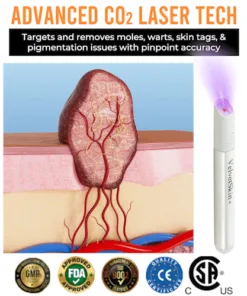 Bikenda® 𝒱𝑒𝓁𝓋𝑒𝓉𝒮𝓀𝒾𝓃+ All-in-One Laser Eraser Pen