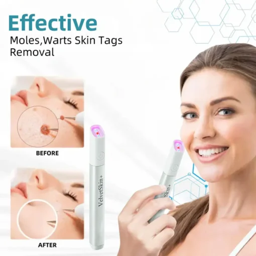 Bikenda® 𝒱𝑒𝓁𝓋𝑒𝓉𝒮𝓀𝒾𝓃+ All-in-One Laser Eraser Pen