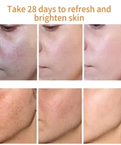 Bikenda™ Blemish Removing Beauty Cream