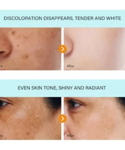 Bikenda™ Blemish Removing Beauty Cream