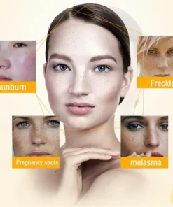 Bikenda™ Blemish Removing Beauty Cream