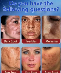 Bikenda™ Blemish Removing Beauty Cream