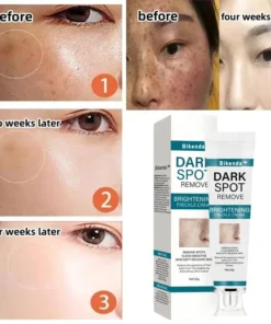 Bikenda™ Blemish Removing Beauty Cream