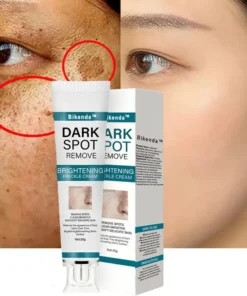 Bikenda™ Blemish Removing Beauty Cream
