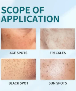 Bikenda™ Blemish Removing Beauty Cream