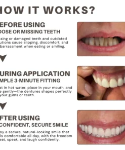 Bikenda® Custom-Fit Full Denture Set