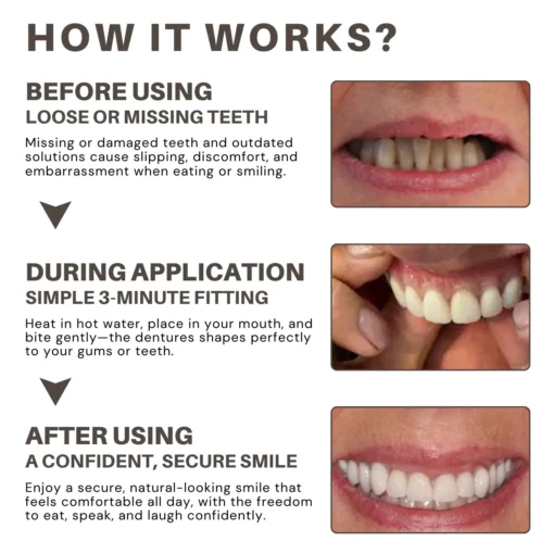 Bikenda® Custom-Fit Full Denture Set