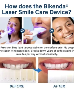 Bikenda® Laser Smile Care Device