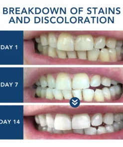 Bikenda® Laser Smile Care Device