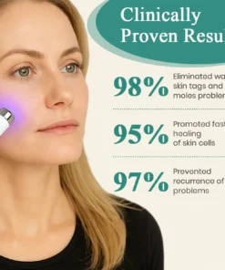 Bikenda® Mole and Wart Instant Removal Laser Pen