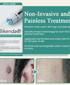 Bikenda® Mole and Wart Instant Removal Laser Pen